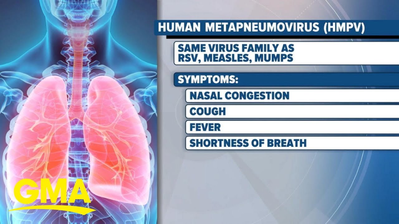 Viral disease HMPV is on the rise among kids in China — what is it?